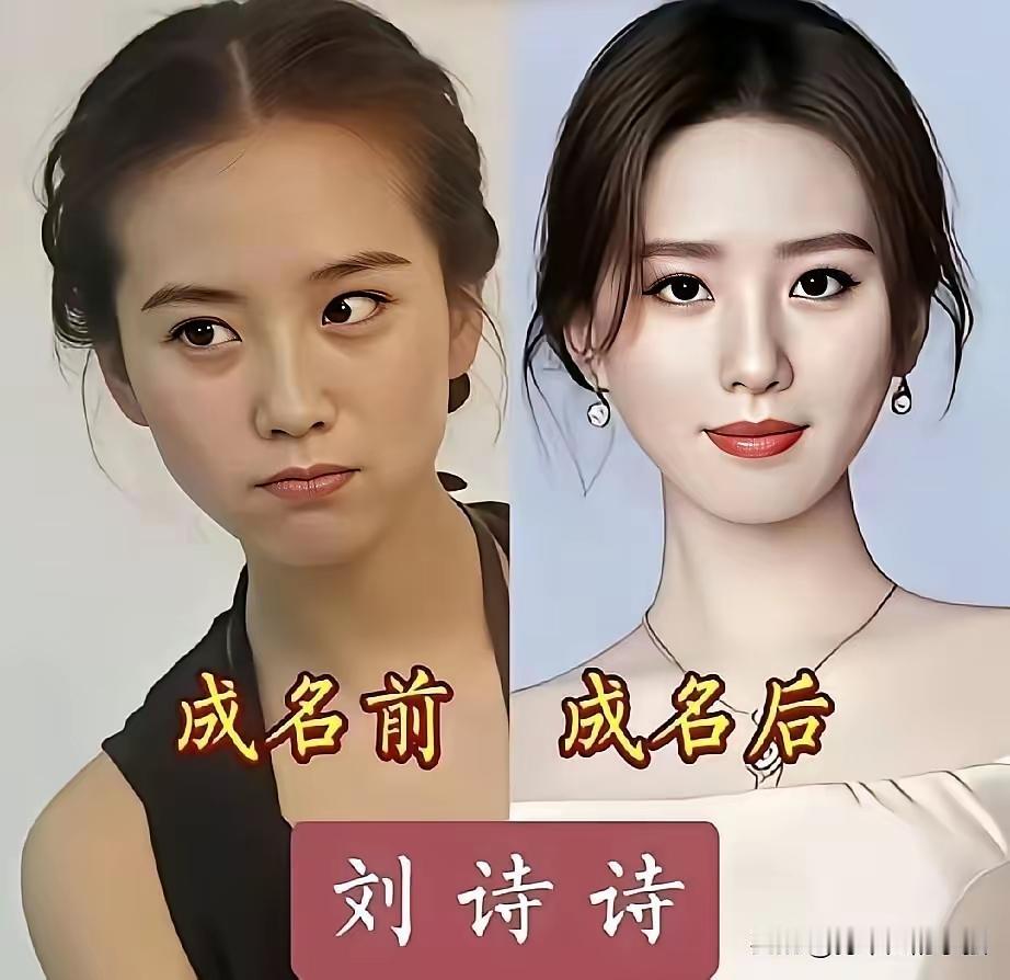 女明星成名前VS成名后！变化最大的就是钟楚曦了吧，以前看起来是这种圆圆的肉肉的