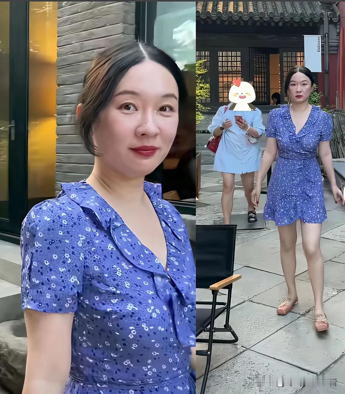 霍思燕真的是一点儿也没有容貌焦虑症。那么多明星都现在靠打针，靠医美来保持容颜，霍