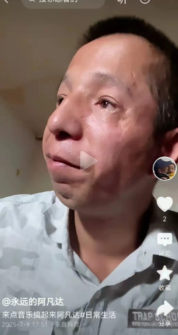其实阿凡达还是很有实力的，阿凡达的拍剧虽然是跑龙套的，但是因为他是特型演员，所以