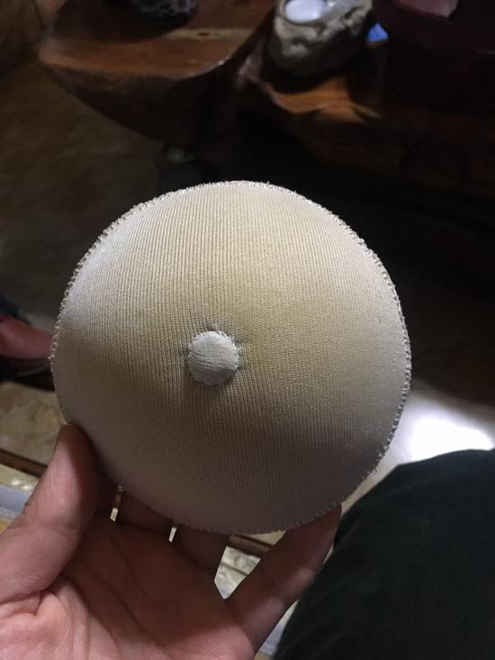 乳腺癌术后患者寻找义乳 曾拿绿豆做填充物发芽了