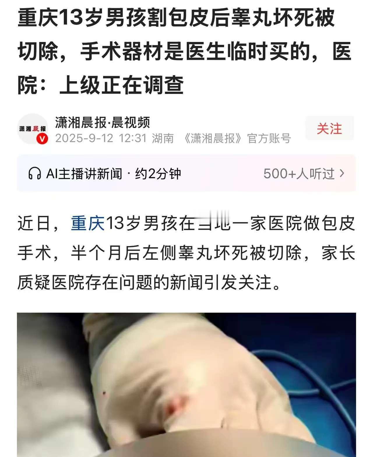 重庆钱先生为13岁儿子选社区服务中心的“熟人医生”做包皮手术，因图方便、信熟人，