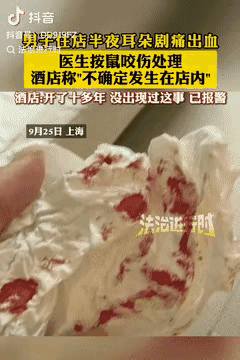 重庆一女子打了女儿一耳光，没想到竟然打掉了女儿的心。2015年，女子的女儿不愿意
