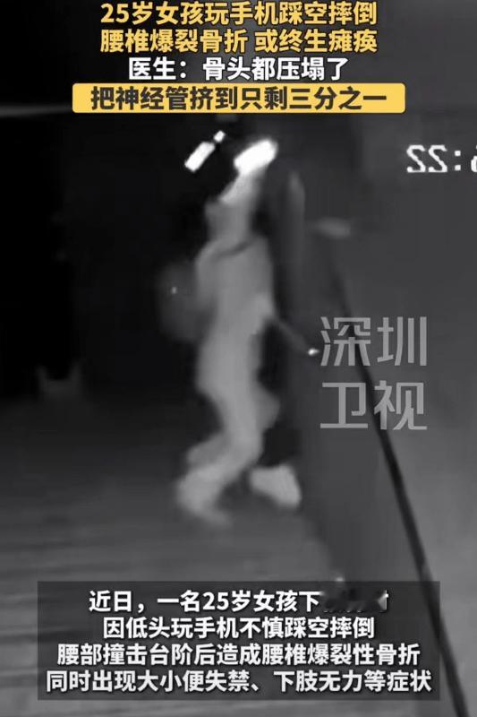 魔怔了！25岁女孩玩手机走楼梯踩空，腰椎爆裂骨折，医生：骨头都压塌了，把整个神经
