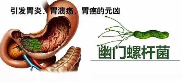 幽门螺旋杆菌是一种螺旋形,微厌氧,对生长条件要求十分苛刻的革兰氏