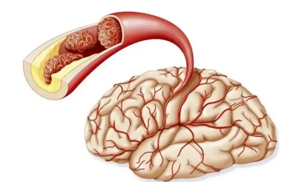 49岁，正是一个女人上有老下有小、撑起一个家的年纪。可就在上周，社区里一位大姐清