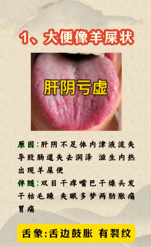 4种肠胃异常，中医教你一次性分清楚