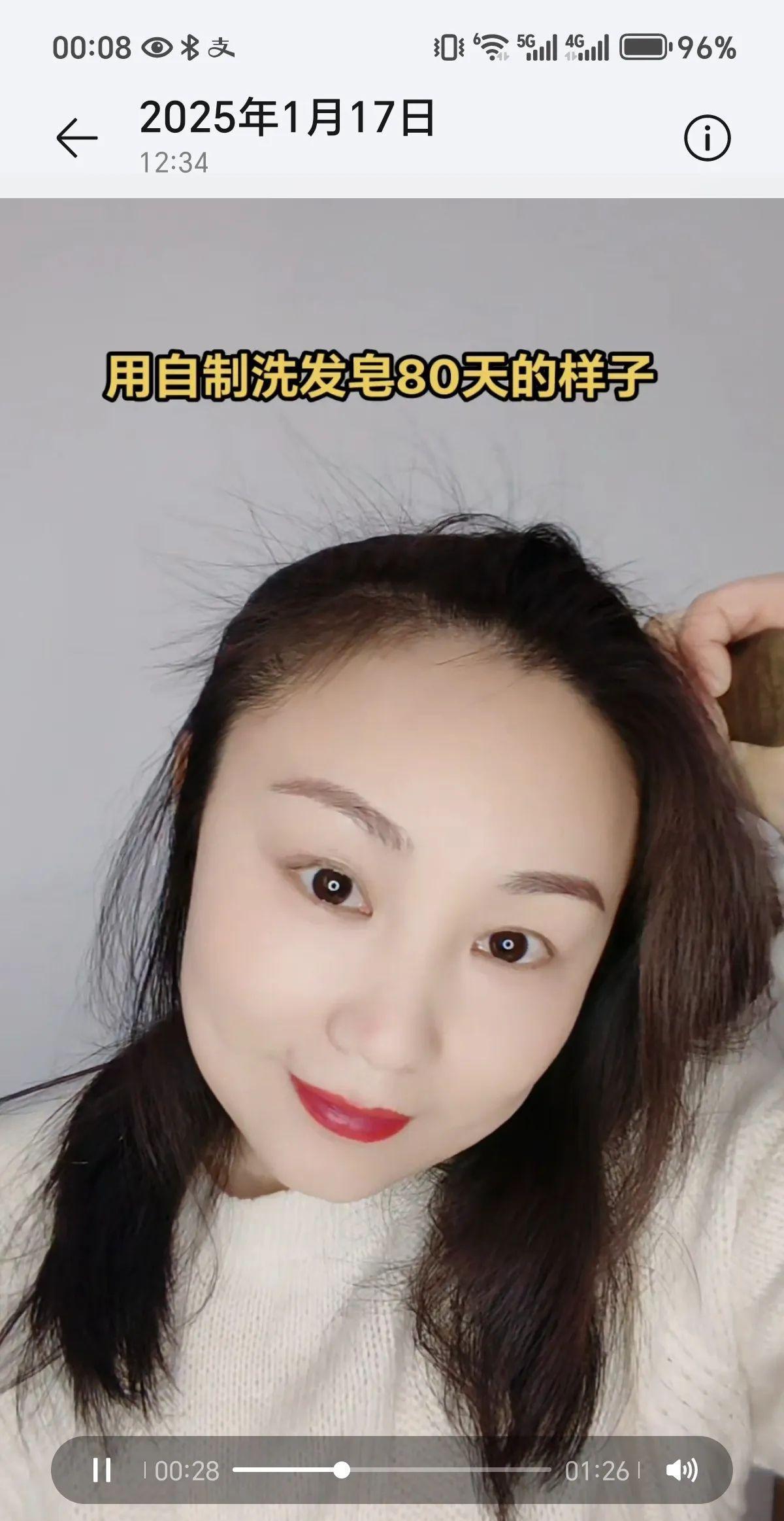 头发掉得厉害怎么办？这是我用自制洗发皂后的效果，半年前我也脱发严重到连耳朵都盖不