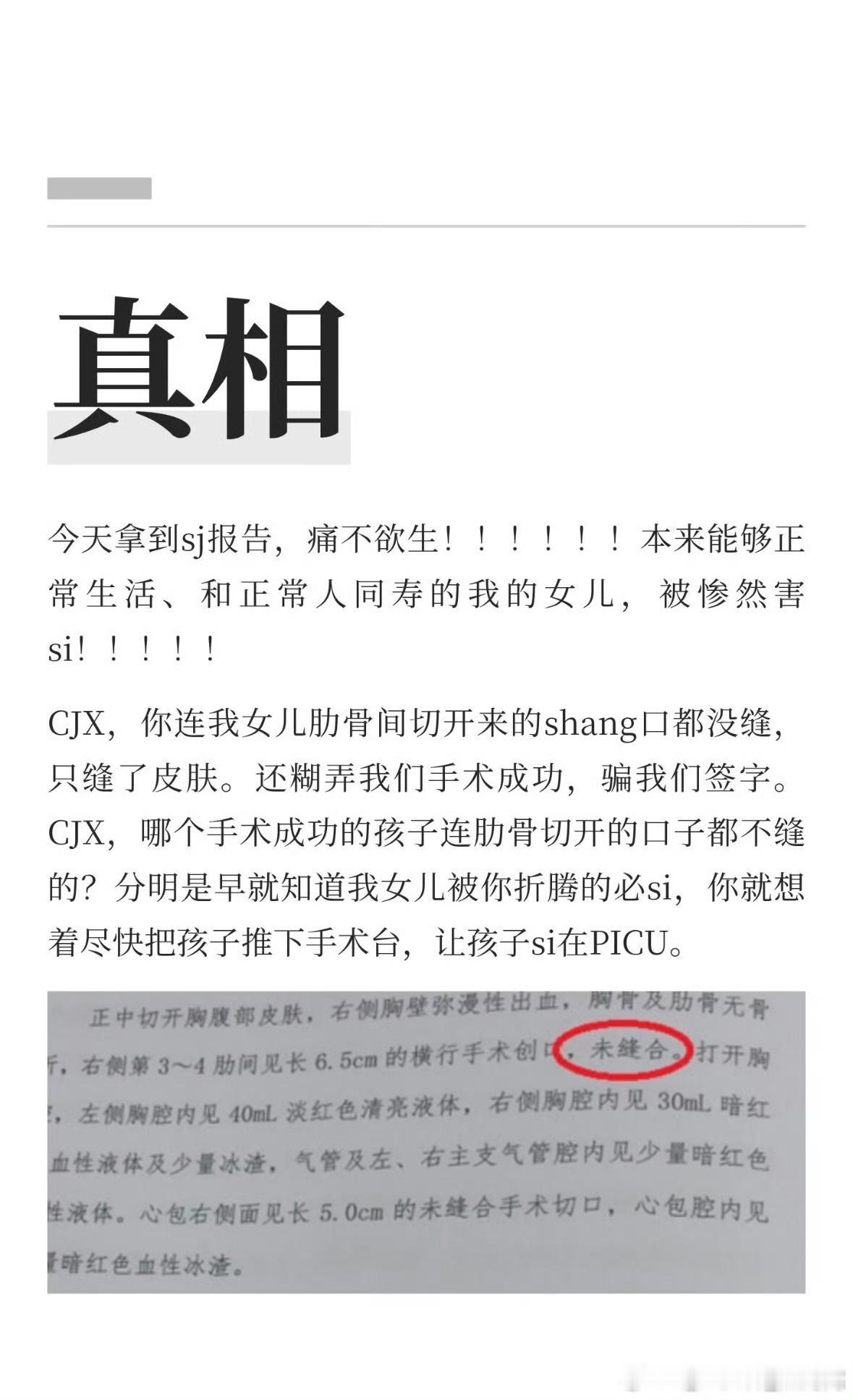 小洛熙真相只有一个3mm房缺这么大医院的大主任医德沦丧！不配做人！整个手术团