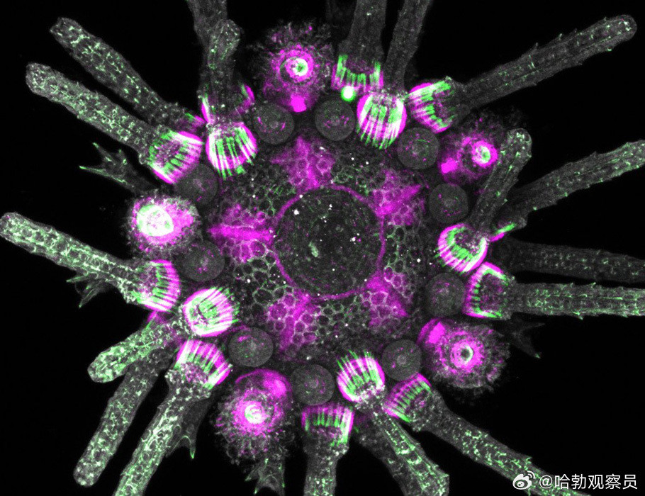 最新研究发现：海胆全身遍布“脑袋”！11月5日，发表在ScienceAdvan