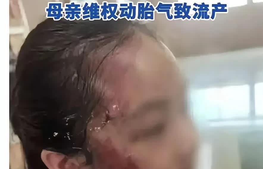 好惨啊！广东茂名化州，万达广场一女子欲跳楼，被多名店员拦下。原来数月前她带女儿到