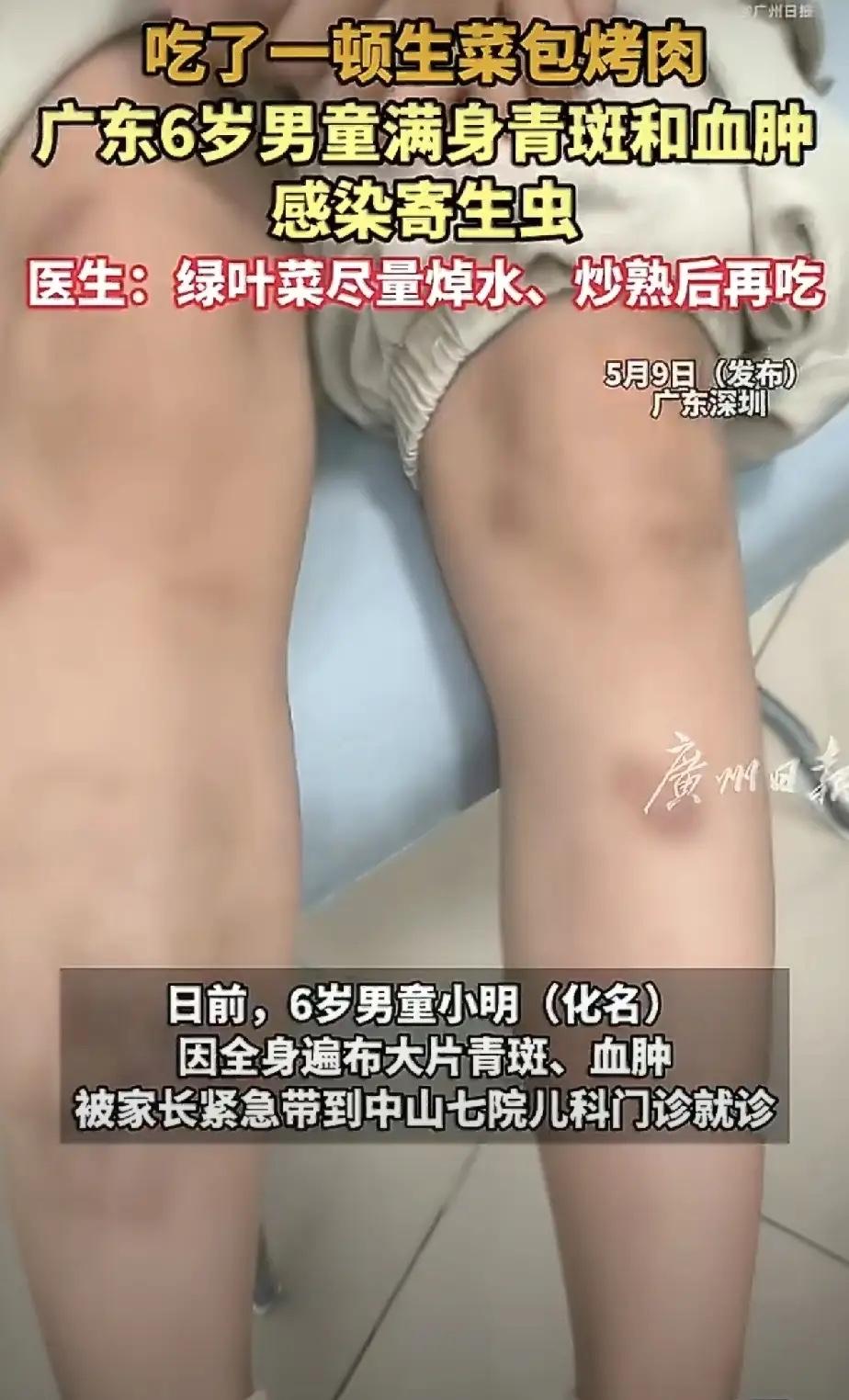 爱吃生菜、常吃凉拌菜的人，真别再盲目大意了。现在不光生菜要谨慎，就连黄瓜西红