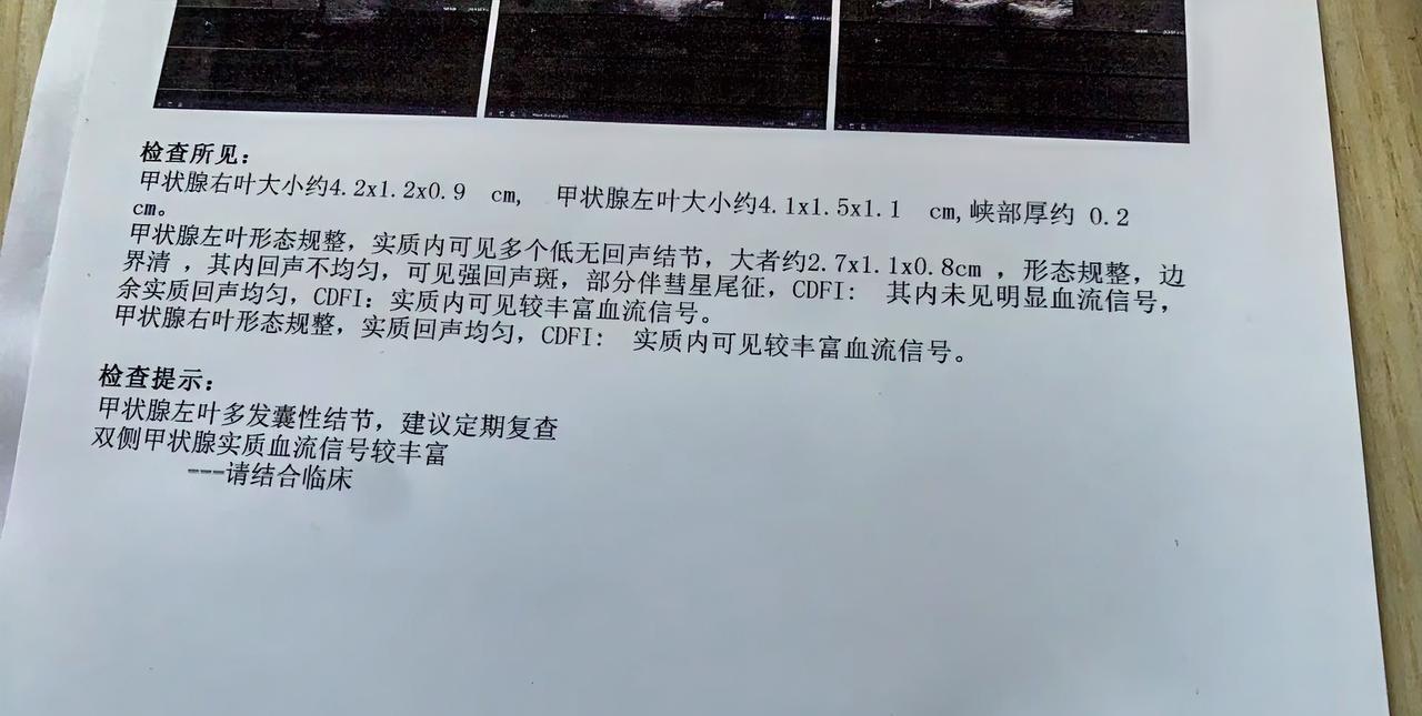 53岁的年龄，爱添毛病的年龄，昨天姐姐满腹心事的跟我说周六日让我陪她去做个甲状腺