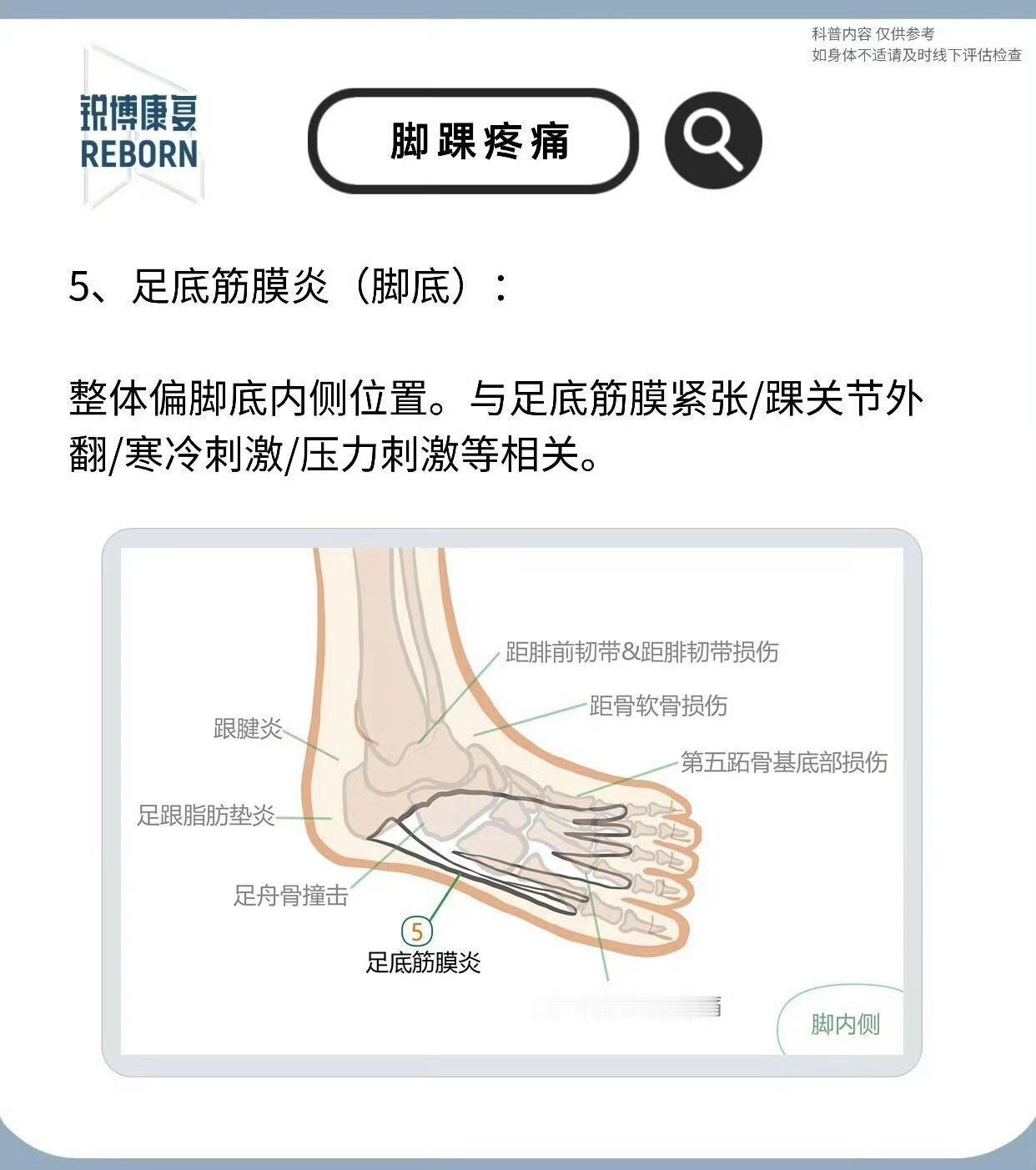 脚踝康复脚踝总是疼，但找不到具体的地方，也不知道为啥疼？下面帮你总结8个常见疼