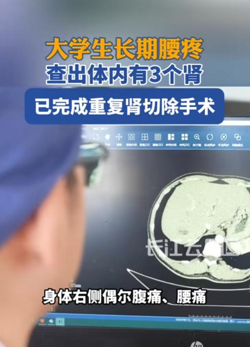 陕西西安，一21岁大学生长期被腰疼折磨，本以为只是久坐或劳累所致，未料在学校体检