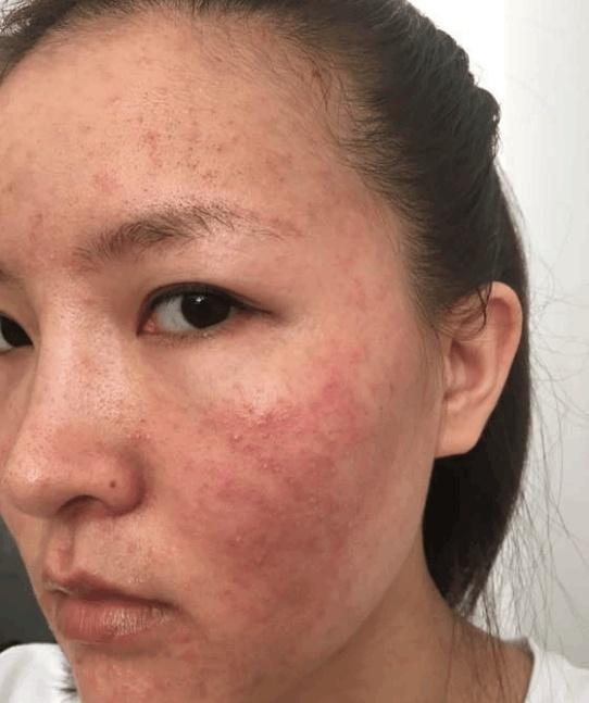 奶奶八十似三十, 只因用它敷脸, 美白祛斑, 冻龄少女肌肤永不衰老