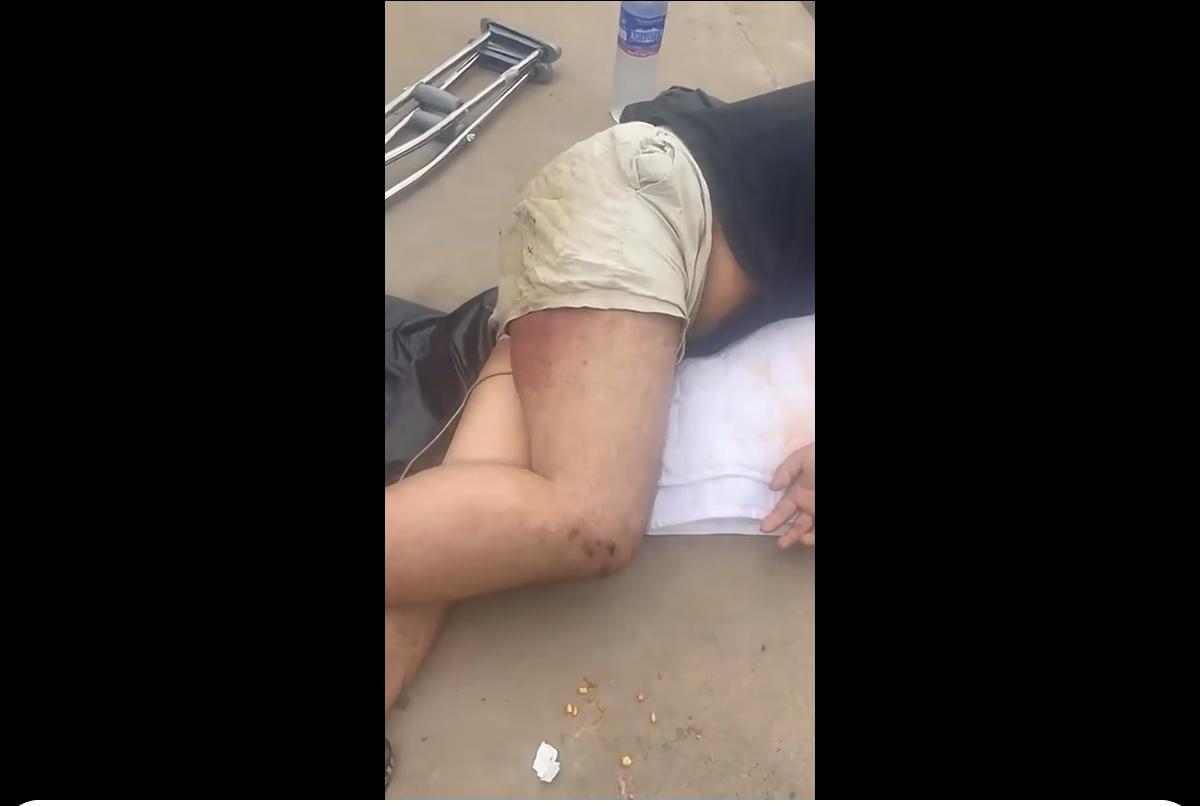 一条疑似一异国男子在柬埔寨被打了并被丢在路边的视频，看了真让人心痛不已。从视