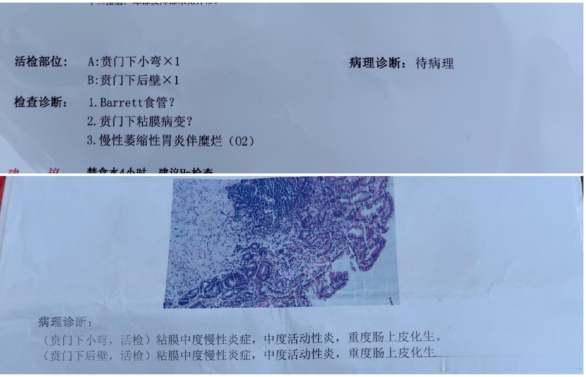中药粉剂治疗脾胃病的效果在附近的一个村里给传开了有好的一方面就有不好的一方面最开