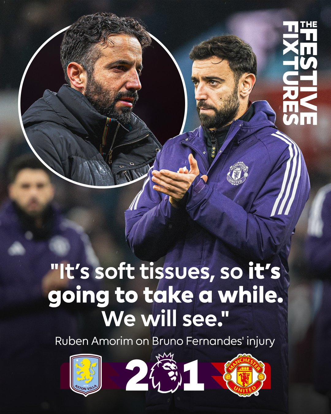 【B费伤情】维拉2比1曼联，赛后阿莫林透露了队长B费的伤情：“那是（肌肉）软组织