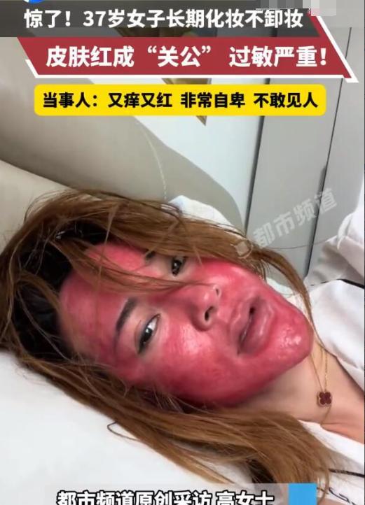 吉林37岁女子从15岁开始化妆，就没有卸过妆。好不容易勤奋一次，心血来潮卸了个妆