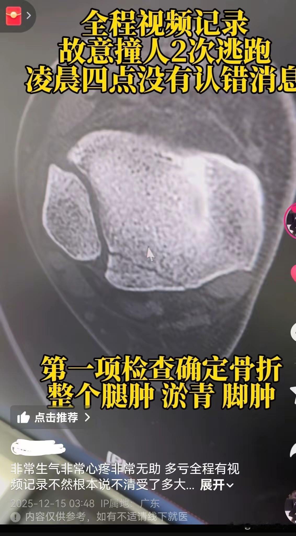 12月14日晚，广州花都街头发生了一起恶劣的撞人逃逸事件。行车记录仪显示，黑色轿