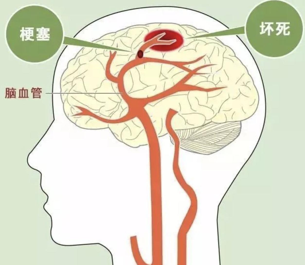到了40岁，告诉你几件能救你命的几件事现在那么多脑梗、心梗、猝死，都跟这些有关
