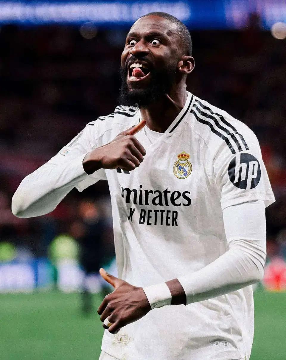 这货有精神病吗？被皇马势力宠坏，肆意妄为，自己人都看不起他，把他淘汰出世界杯名单