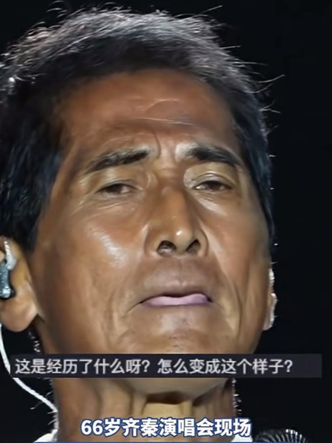 66岁的齐秦一登台，一张嘴，全网都在问牙怎么了。有人猜口腔癌，有人传戴假牙。其实他那一口牙，是嚼槟榔