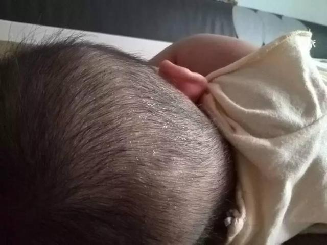 宝宝一睡着就满头大汗, 这是生病了还是正常的? 还是缺少什么导致的