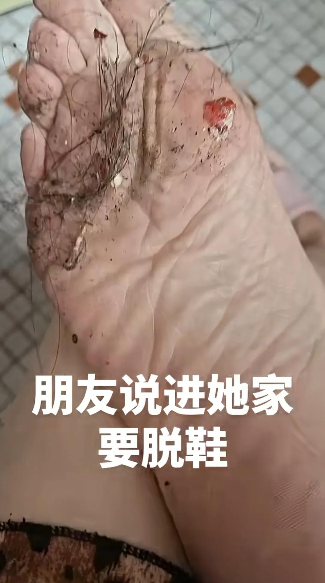 家人们遇到这种情况怎么委婉的告诉朋友？