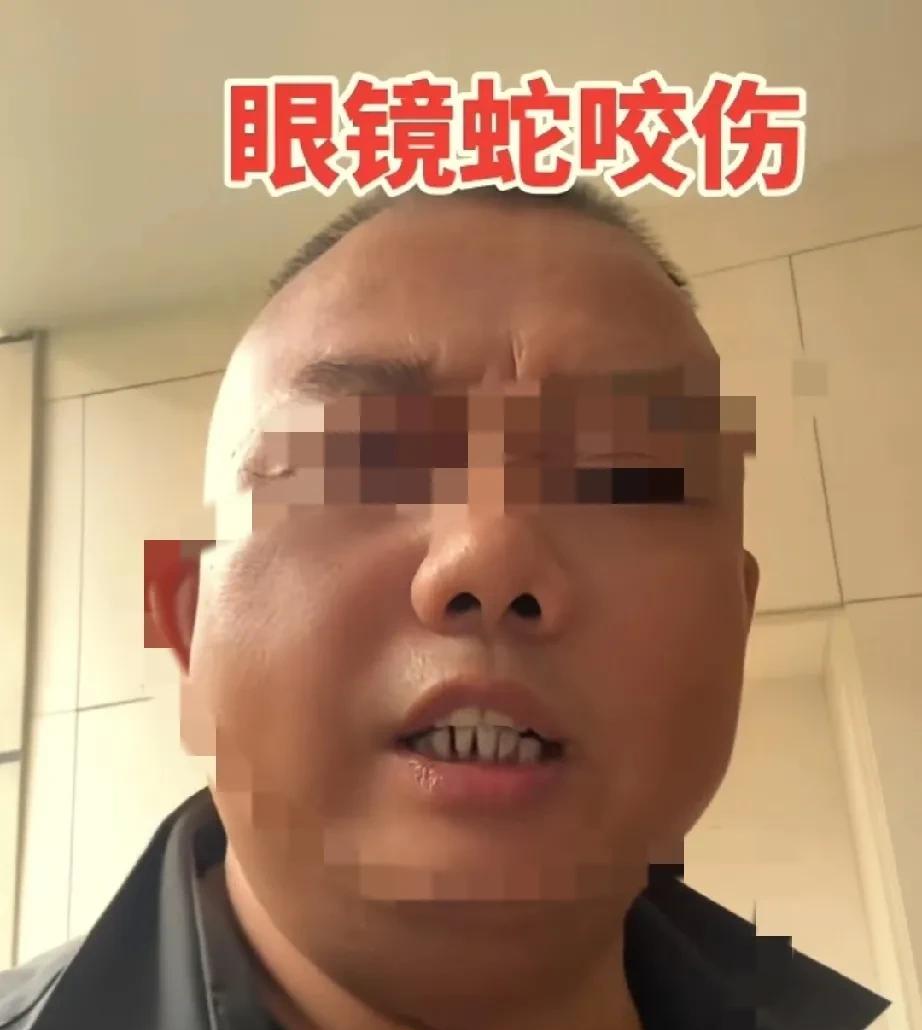 三亚被蛇咬女子走，一个教阿宝博主火了。1、撕裂伤，无毒蛇2、有两个窟窿眼的，