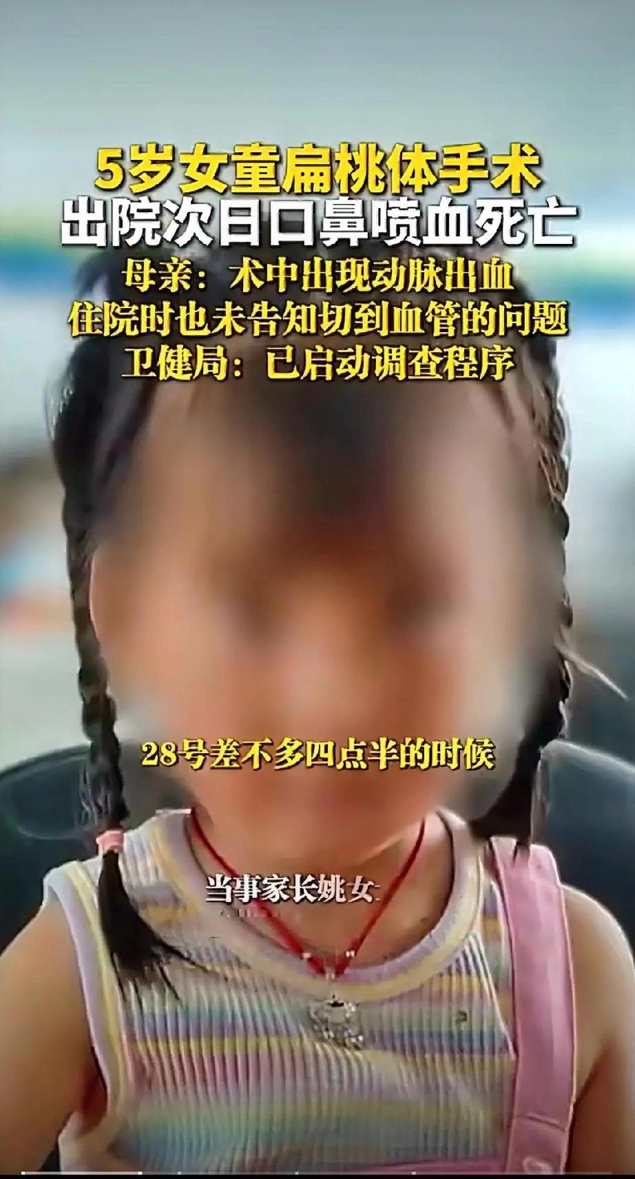 云南5岁女孩事件，医院犯下的三大错：第一、术中伤到动脉，扁桃体切除是很成熟的