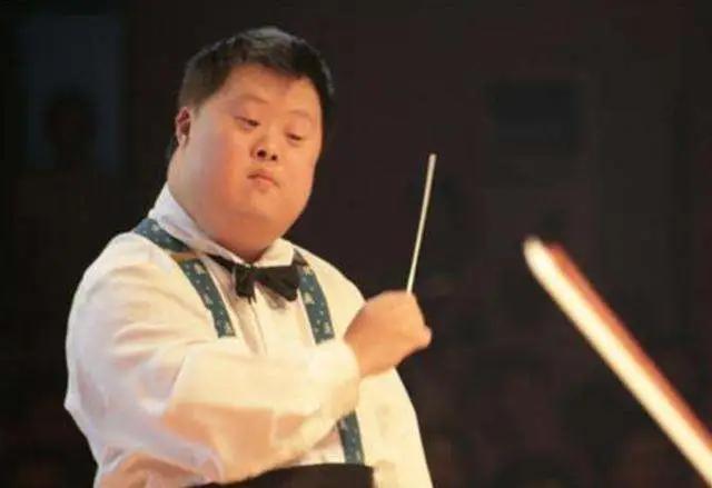 为啥得了这个唐氏综合征的患者的外貌相似度这么大呢！说是他们是身体里缺少了一种基因