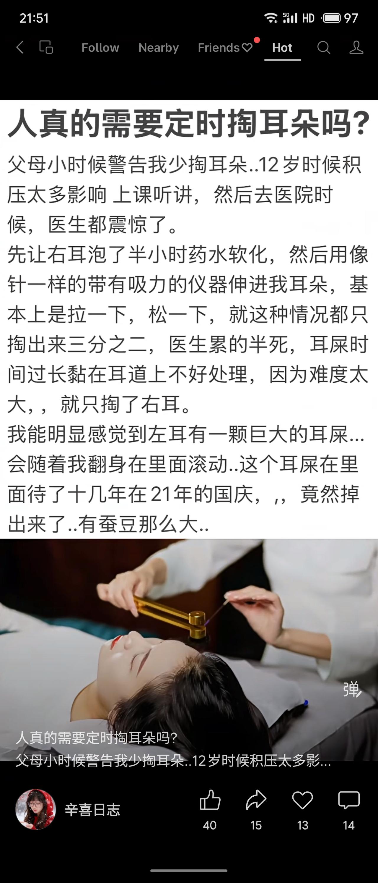 今年冬天的不同耳道有自洁功能，一般无需频繁掏挖。作者幼年因积压过多致就医，医生处