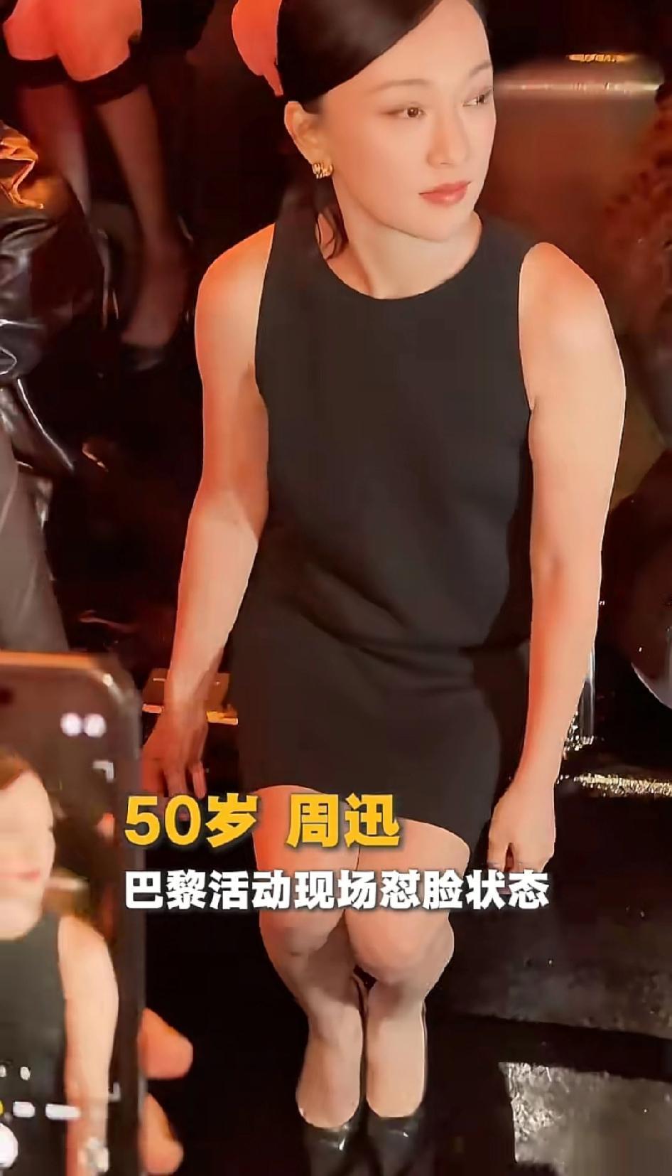 她们突然不老了，任何普通医美是不可能有这样的状态，去年还这样呢，今年有新技术了