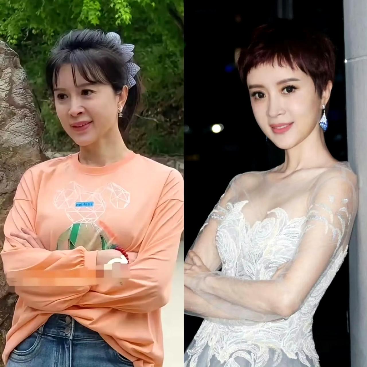 好家伙！金巧巧自曝30年前（那可是1994年啊！）就冲在医美前线了！那可是别人还