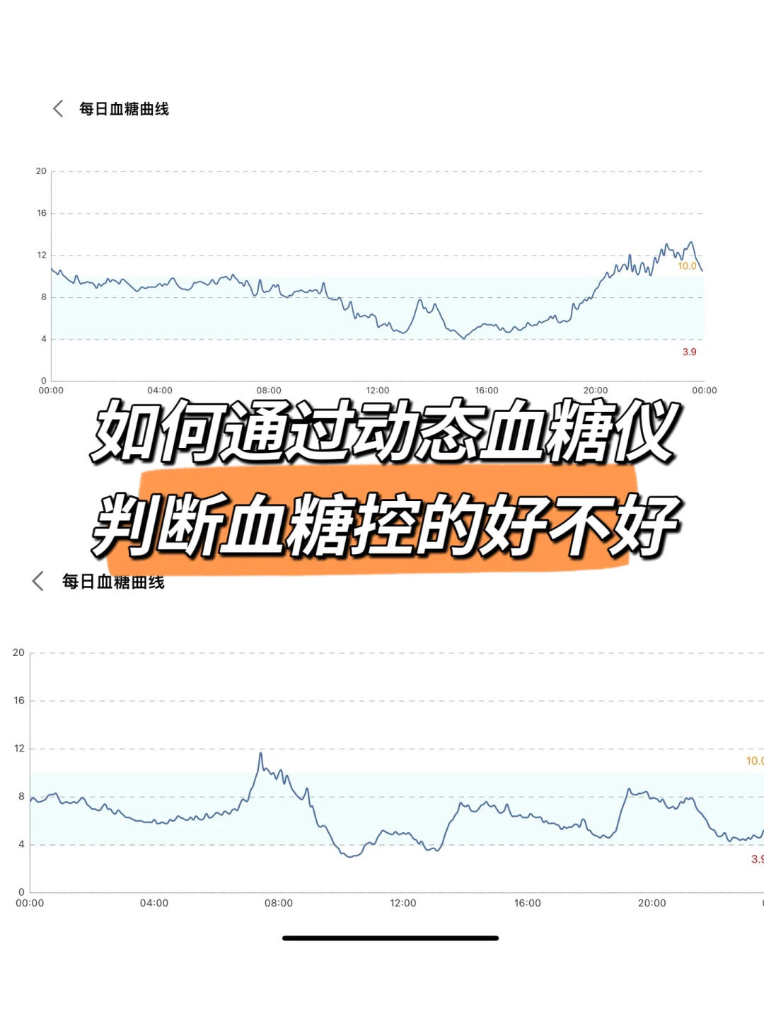 动态血糖图谱 | 教你一眼看懂血糖控制情况