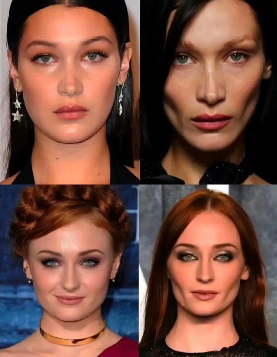 这种是自然瘦的脸颊凹陷还是do的