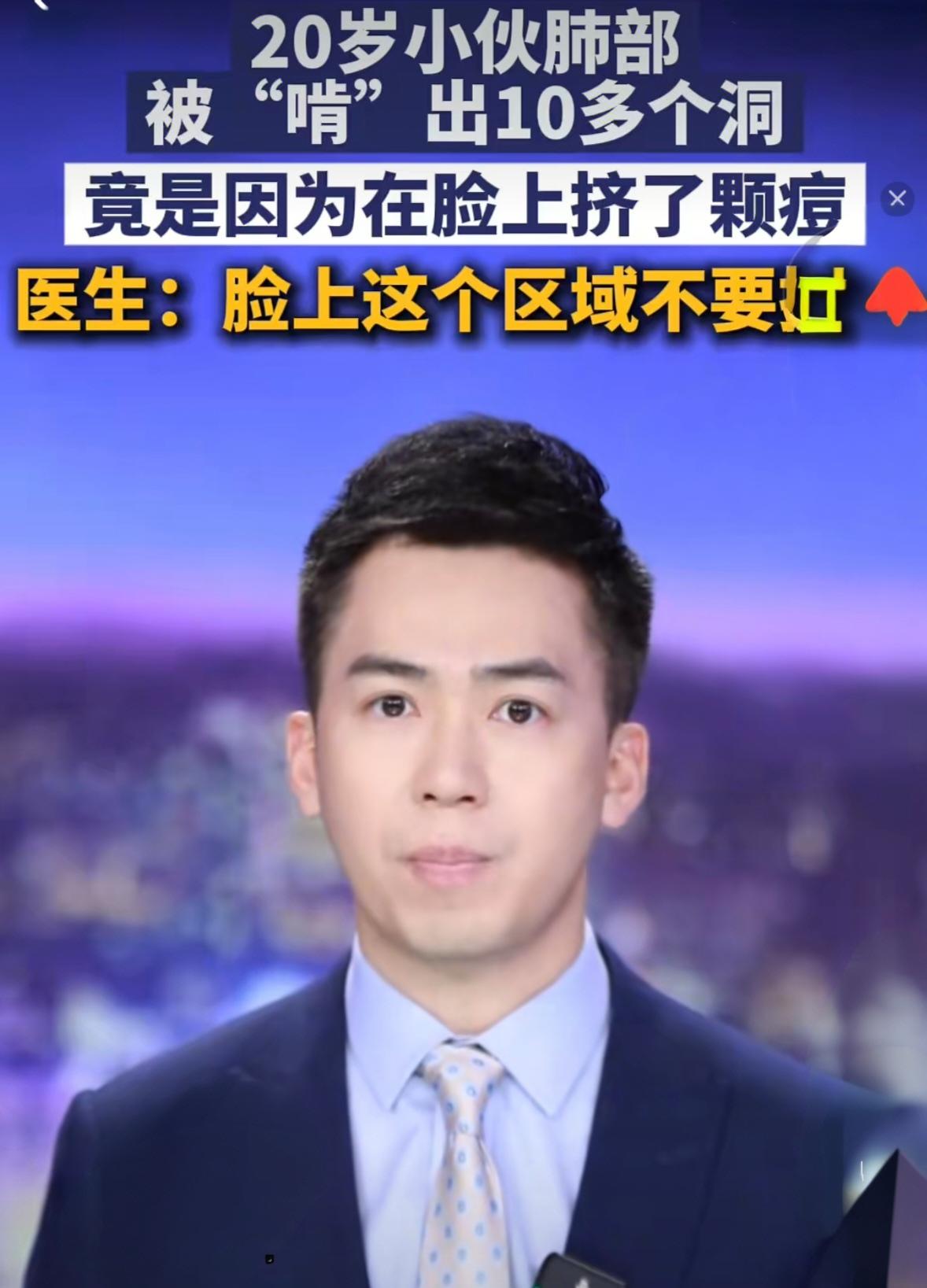 挤一颗痘痘竟致肺里现十几个空洞！大二学生的惨痛教训20岁的大二学生小林为备