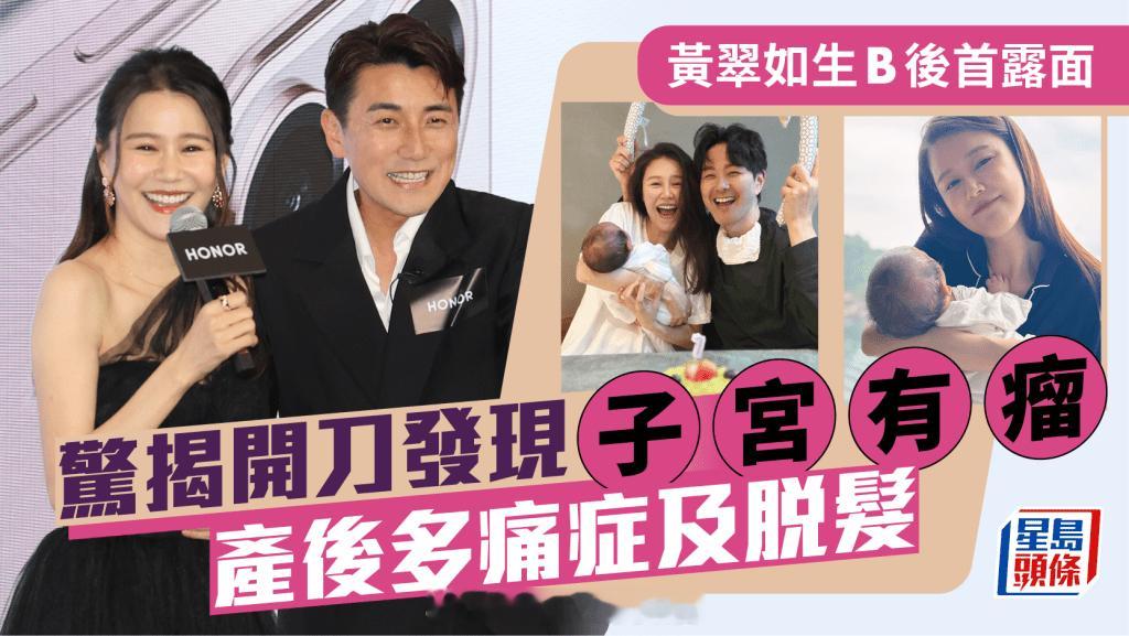 黄翠如复工揭生B过程开刀发现子宫有瘤-产后多痛症及脱髮-公开唔搞百日宴原因|