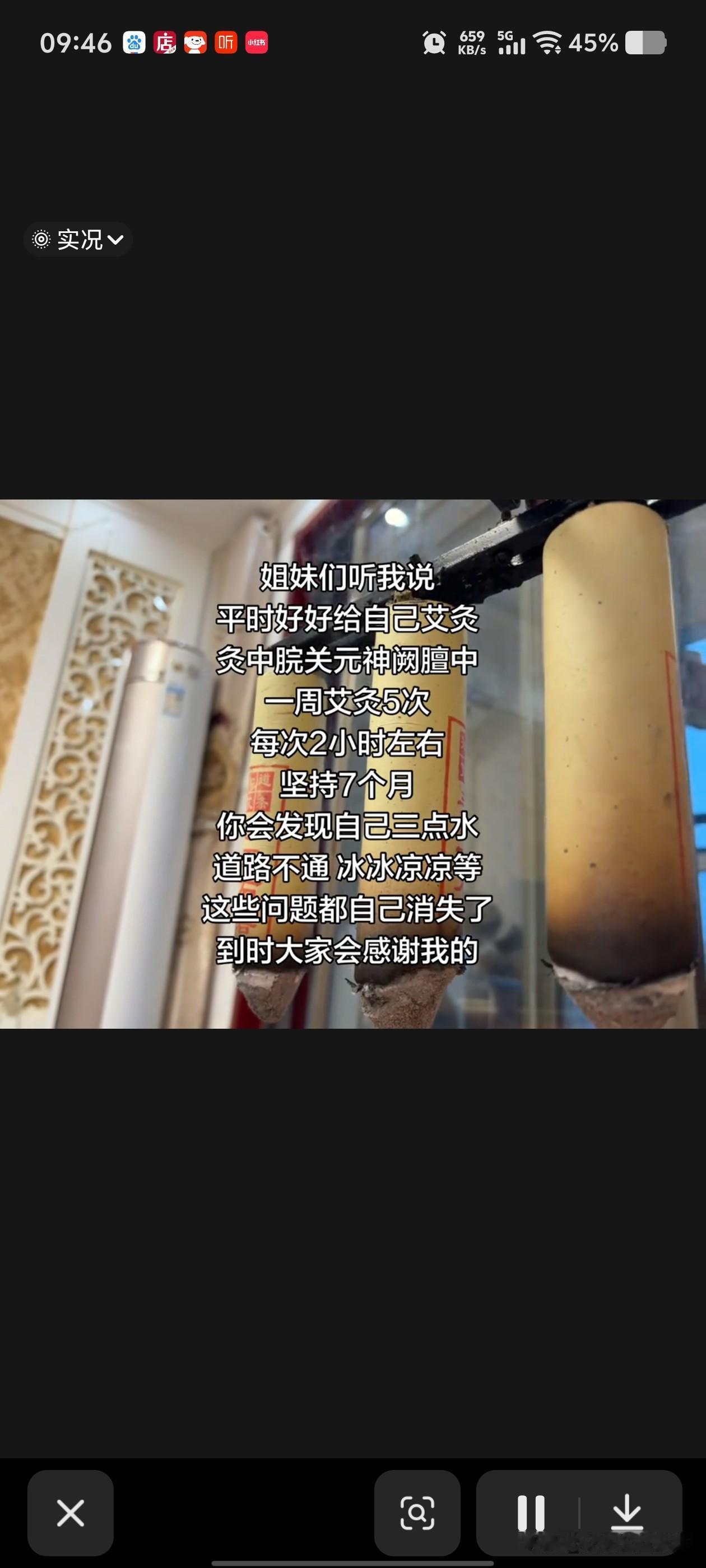 当今艾灸流派，你支持哪一种？第1个就是三大穴，艾灸，这三个穴位有的就上三年，5