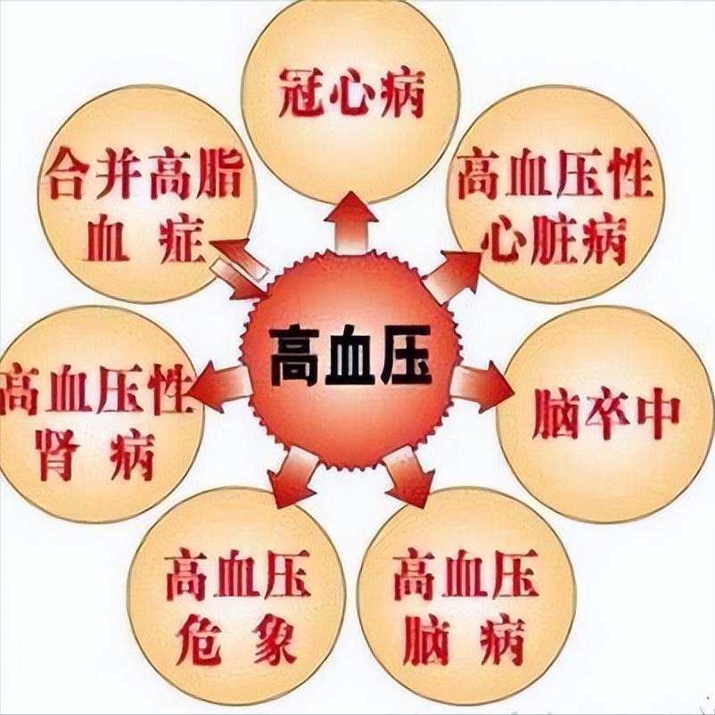 高血压不是小事！长期不管会致命的 1.大脑中风高血压是导致脑卒中的最主要