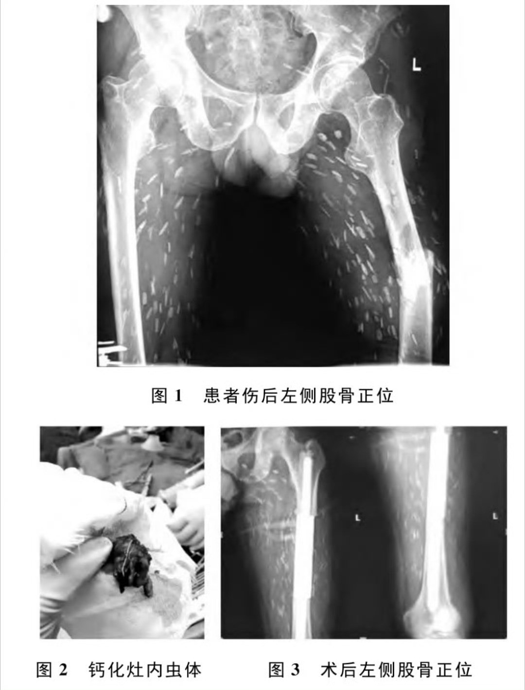 不要生吃或半生吃猪肉牛肉大图慎点。一个喜欢吃生猪肉的大爷。¹虫子可以寄生在脑子