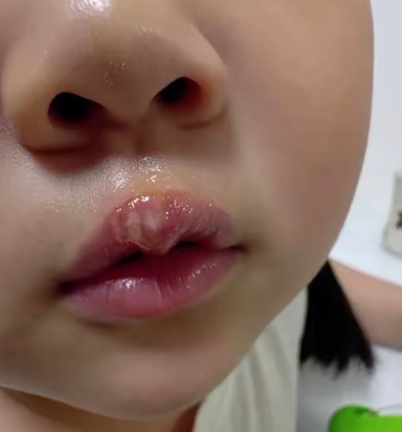 孩子被热熔胶烫伤家长发声作为一名父亲，一定要发声！这种行为简直令人发指！！大连
