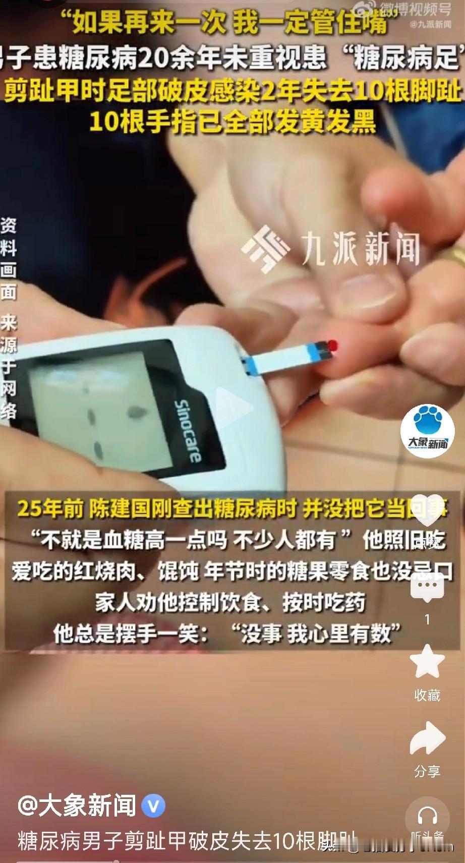“我心里有数！”男子25年不管嘴，如今十根脚趾全截肢！“不就是血糖高一点嘛