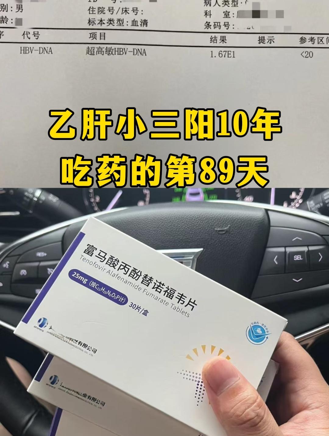 “乙肝小三阳10年了，今天是抗病毒的第89天！”今天济南本地的患者到院...