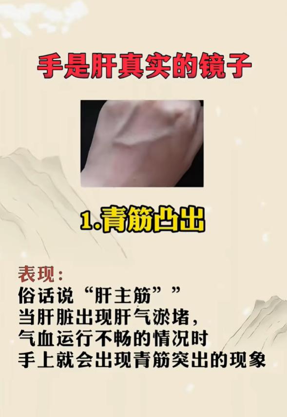 中医讲“肝主筋”，手部是可以直观观察身体状态的窗口。肝脏出现异常时，有时会在手