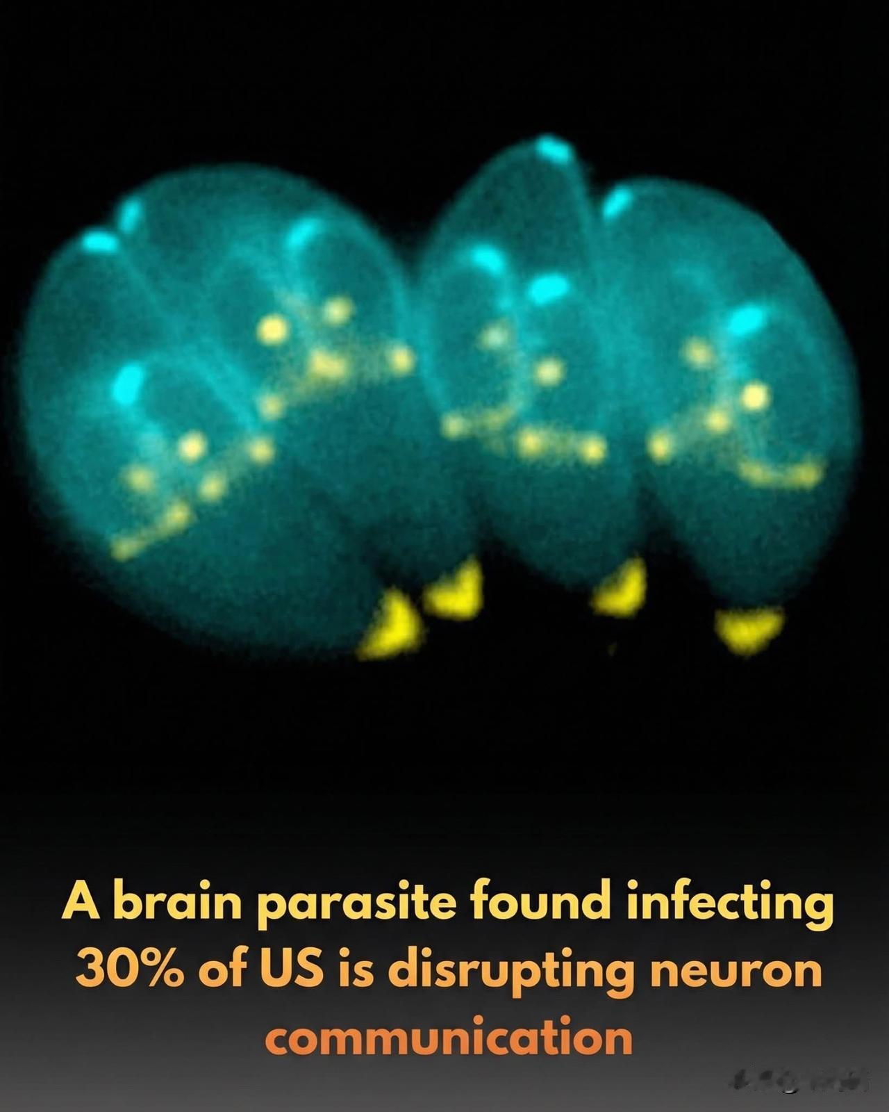 它就在大脑里……而且三分之一的人可能已经拥有它一种名为弓形虫的微小寄生虫可能