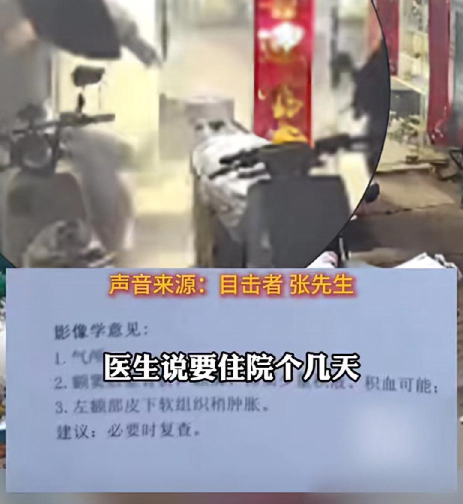 这玻璃门质量过硬！12月3日，河南南阳一老板被着急修车的骑手“贴脸开大”撞碎牙！
