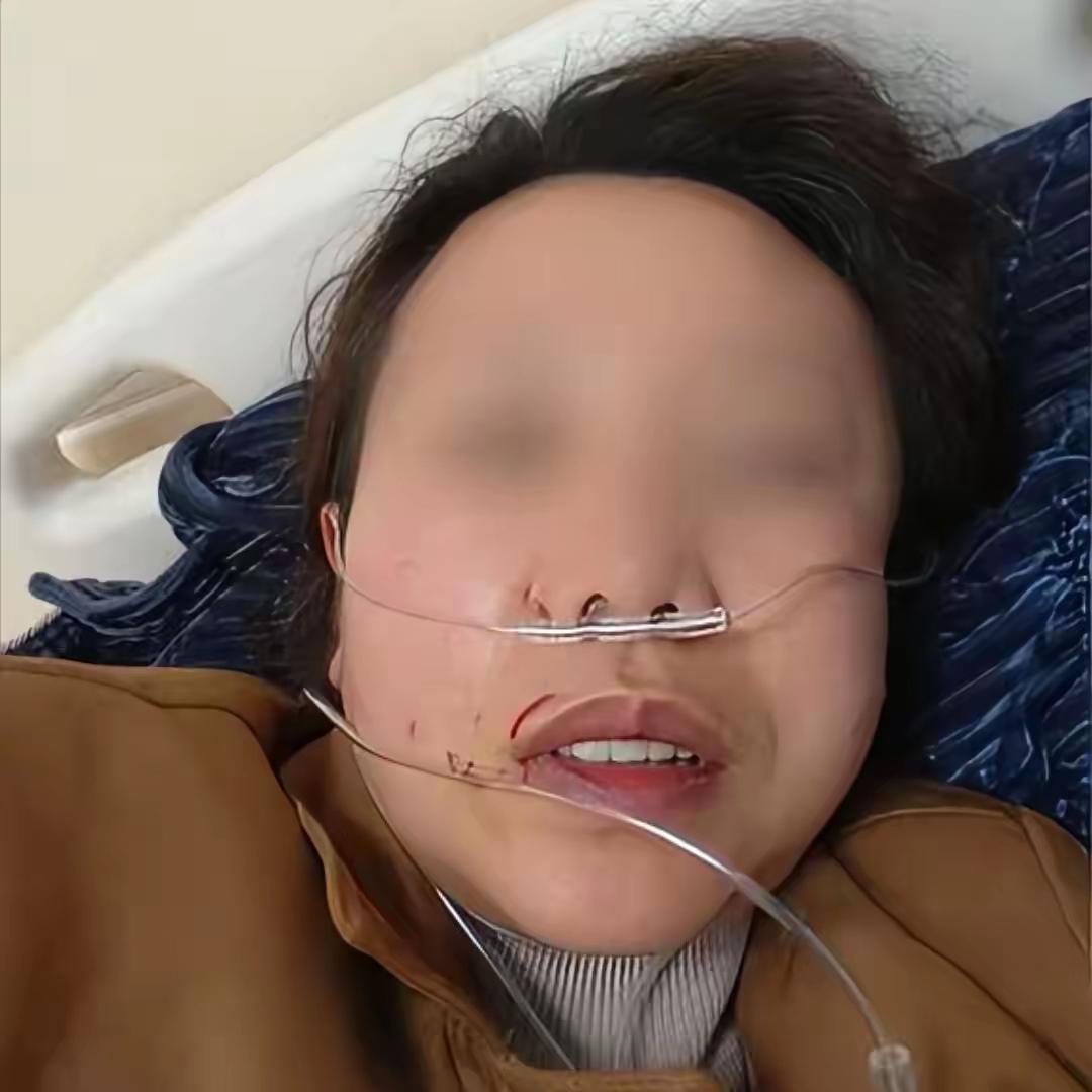 湖南娄底，狱警老公出轨女同事，被处分后，这女人更嚣张了，冲突中打断原配5根肋骨，