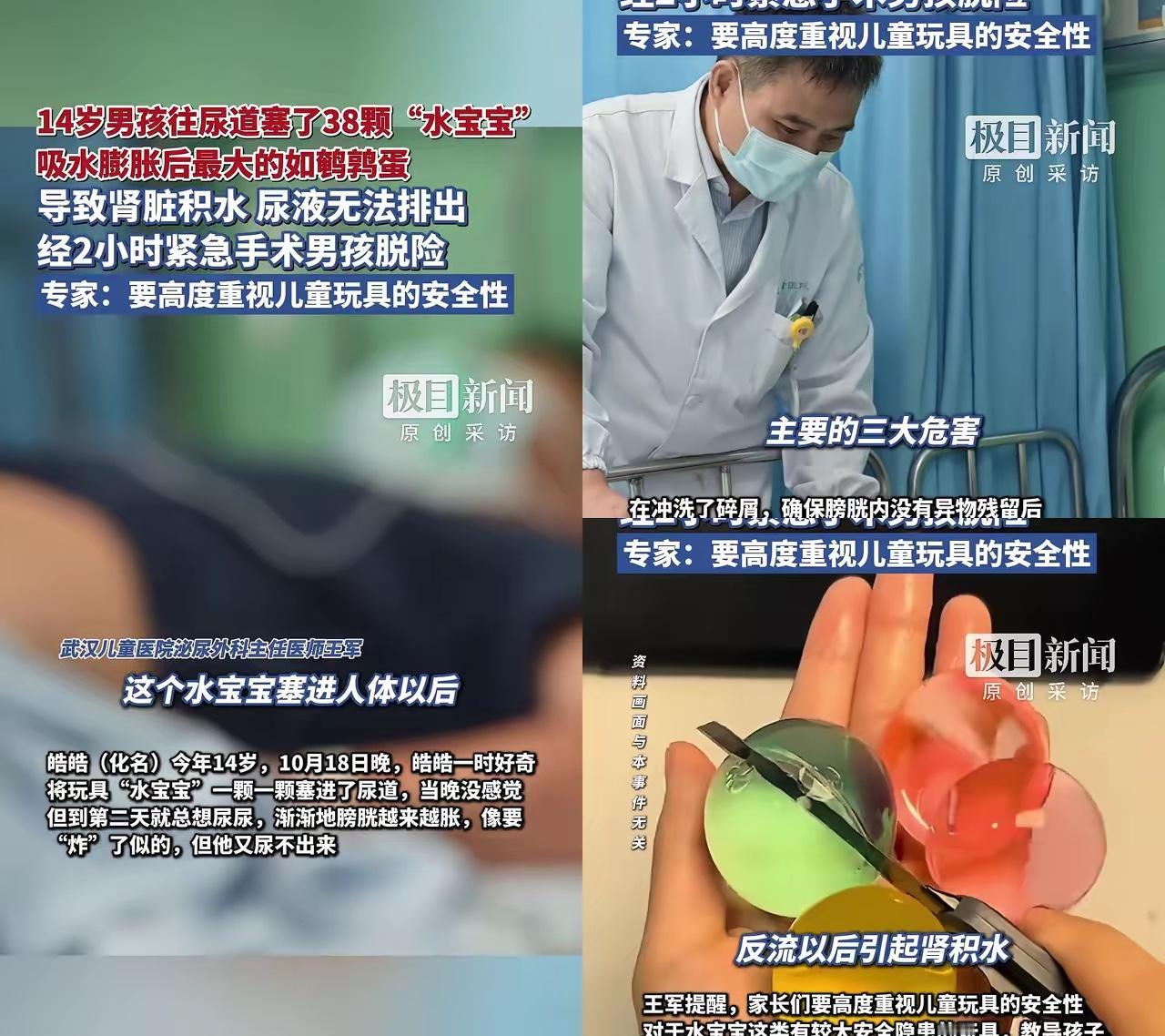 14岁男孩把38颗水宝宝塞进尿道!这事儿看得人后背发凉!谁听说这事儿不冒冷汗